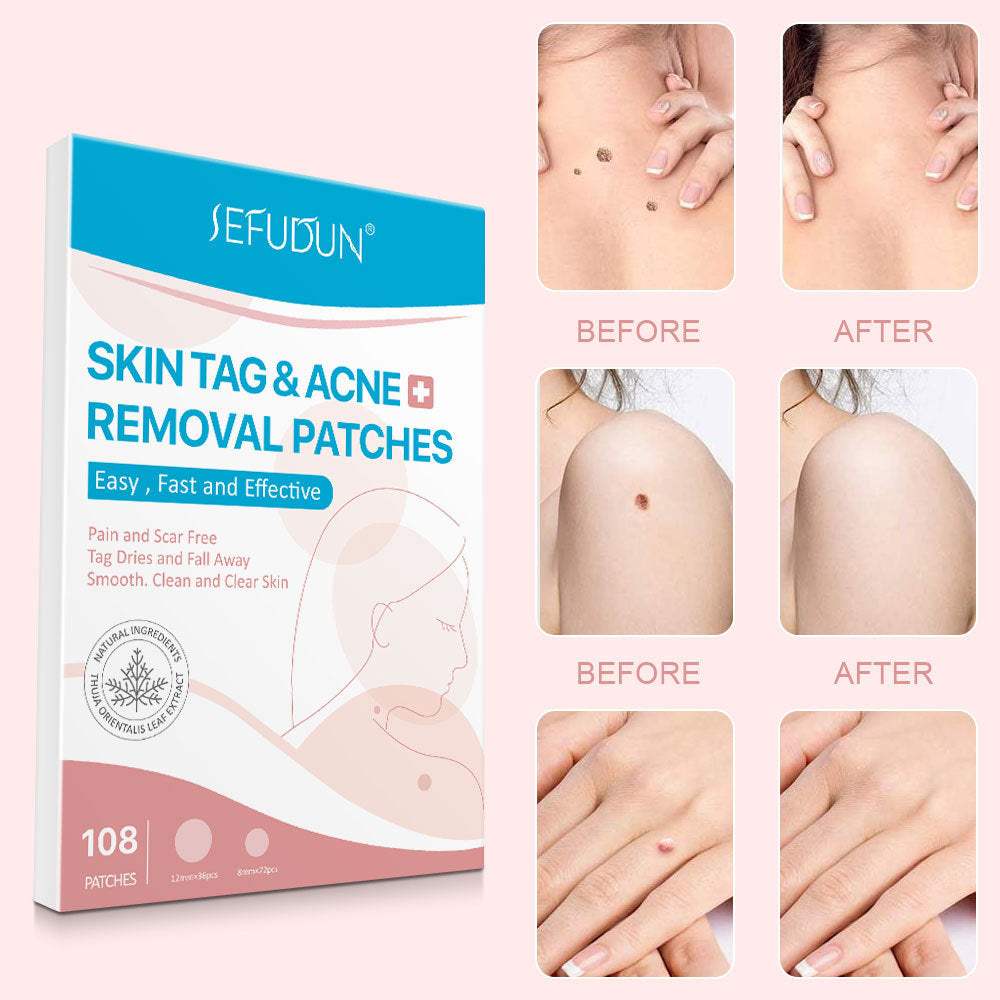Skin Tag Remover Pads